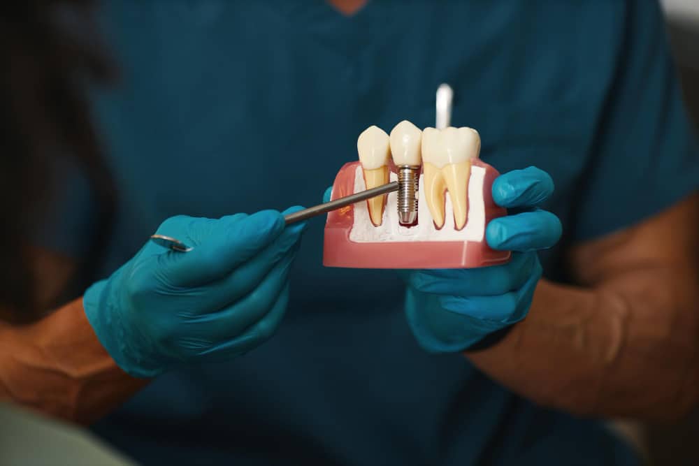 implant-nedir-dis-implanti-tedavisi-nasil-ve-kimlere-yapilir.jpg
